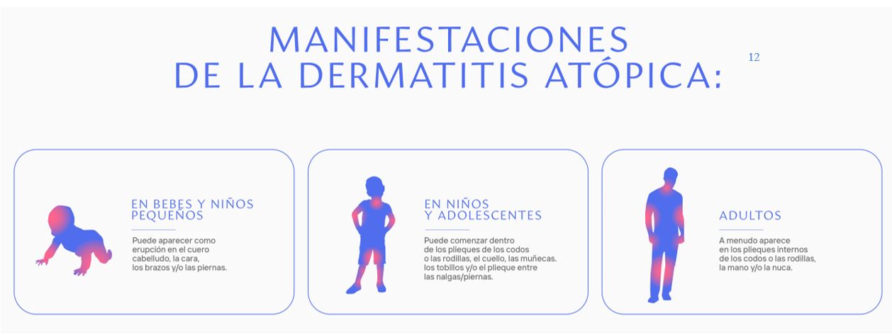 Dermatitis